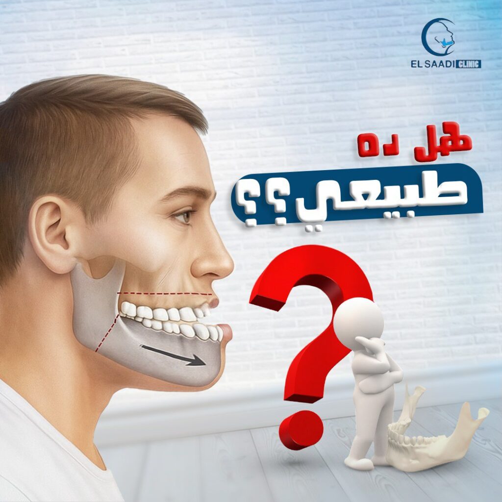 عيادة السعدي دكتور وجه وفكين أسيوط